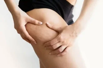 Reduza a celulite naturalmente: um chá de ervas simples para suavizar a sua pele