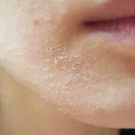 Como Evitar a Desidratação da Pele em Voos Longos: Dicas de uma Maquilhadora