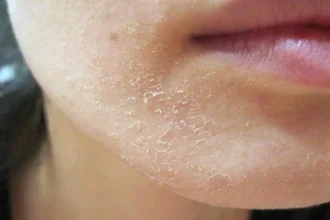 Como Evitar a Desidratação da Pele em Voos Longos: Dicas de uma Maquilhadora