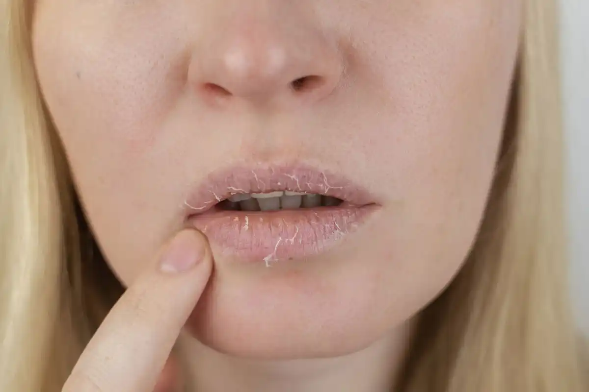 Máscara labial caseira que deixa os lábios macios, carnudos e perfeitos em apenas 10 minutos 